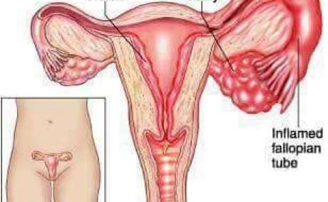 Women Sexual problems Products in Amman Jordan+27 71 009 6483